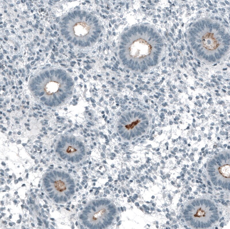 Immunohistochemistry-Paraffin: CD133 Antibody [NBP3-21163] -