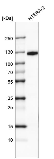 Western Blot: CD133 Antibody [NBP3-21163] -
