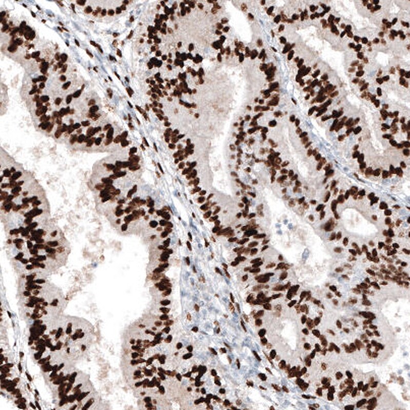 Immunohistochemistry-Paraffin: Progesterone R B/NR3C3 Antibody [NBP3-21167] -