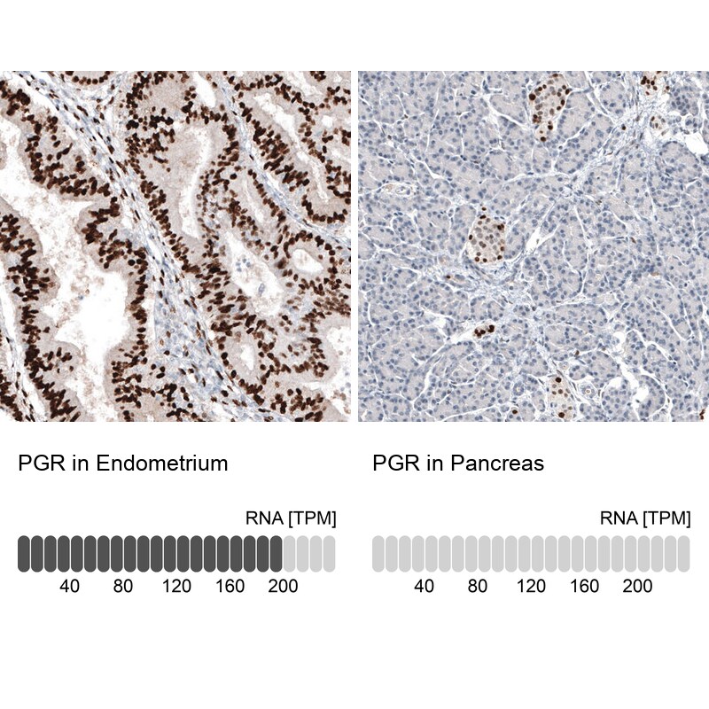 Immunohistochemistry-Paraffin: Progesterone R B/NR3C3 Antibody [NBP3-21167] -