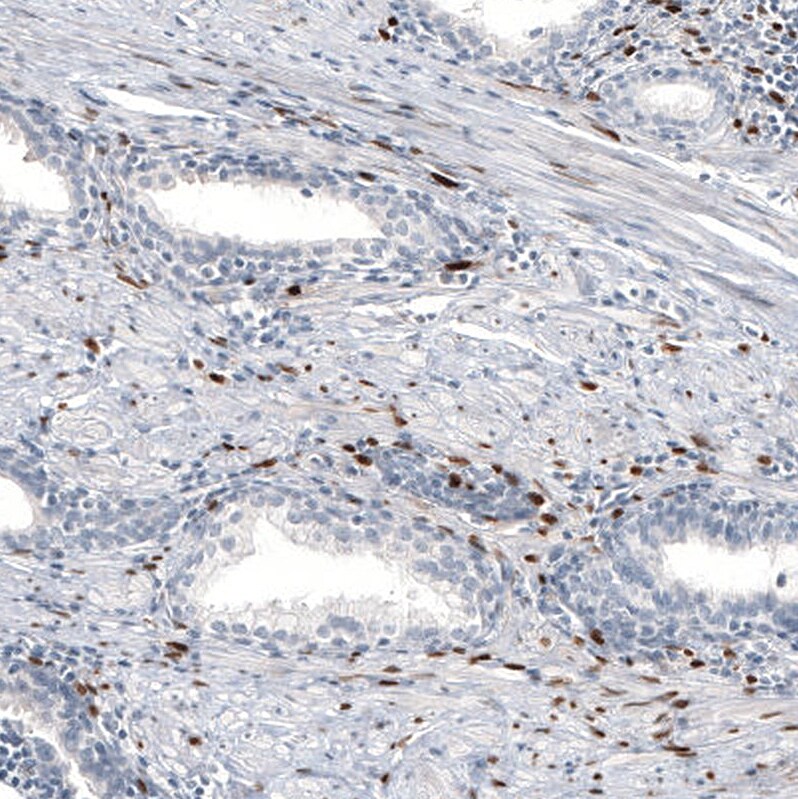 Immunohistochemistry-Paraffin: Progesterone R B/NR3C3 Antibody [NBP3-21167] -