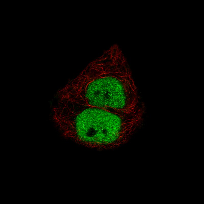 Immunocytochemistry/Immunofluorescence: Progesterone R B/NR3C3 Antibody [NBP3-21167] -