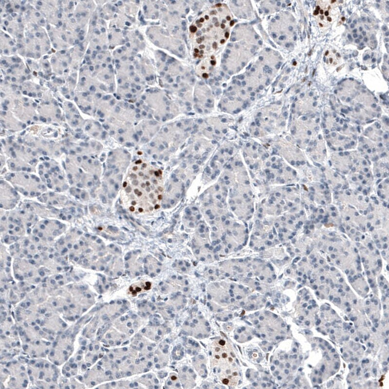Immunohistochemistry-Paraffin: Progesterone R B/NR3C3 Antibody [NBP3-21167] -