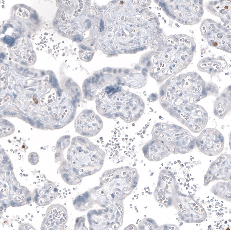 Immunohistochemistry-Paraffin: MUC2 Antibody [NBP3-21168] -