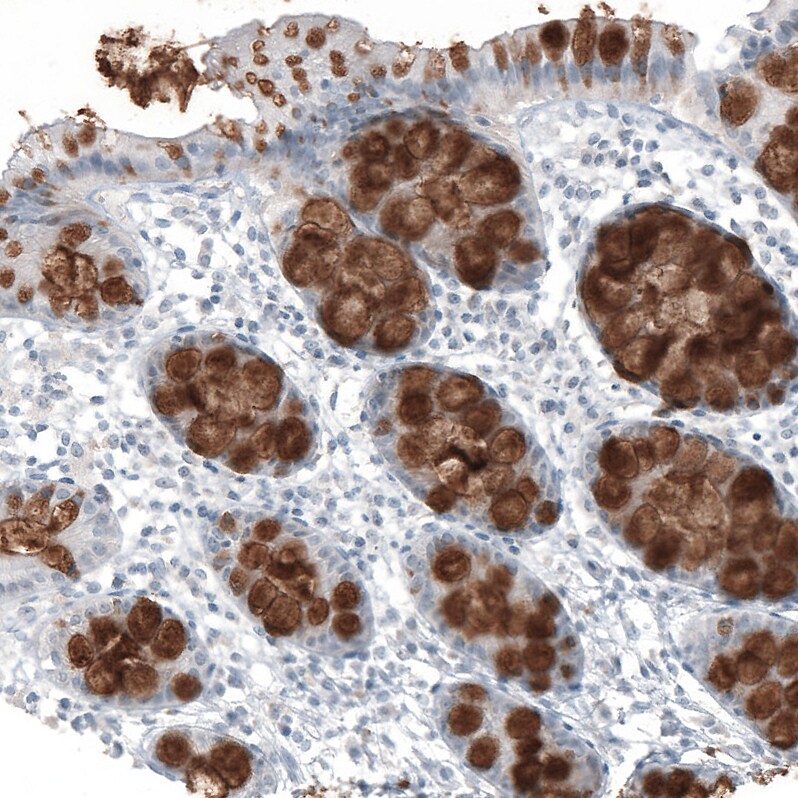Immunohistochemistry-Paraffin: MUC2 Antibody [NBP3-21168] -