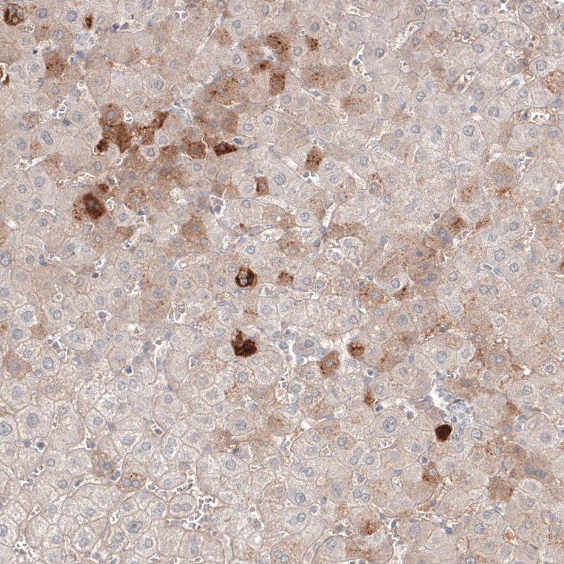 Immunohistochemistry-Paraffin: Serum Amyloid A1 Antibody [NBP3-21169] -