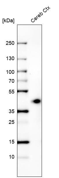 Western Blot: beta-1,3-Glucuronyltransferase 1/B3GAT1 Antibody [NBP3-21170] -