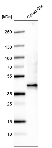 Western Blot: beta-1,3-Glucuronyltransferase 1/B3GAT1 Antibody [NBP3-21171] -