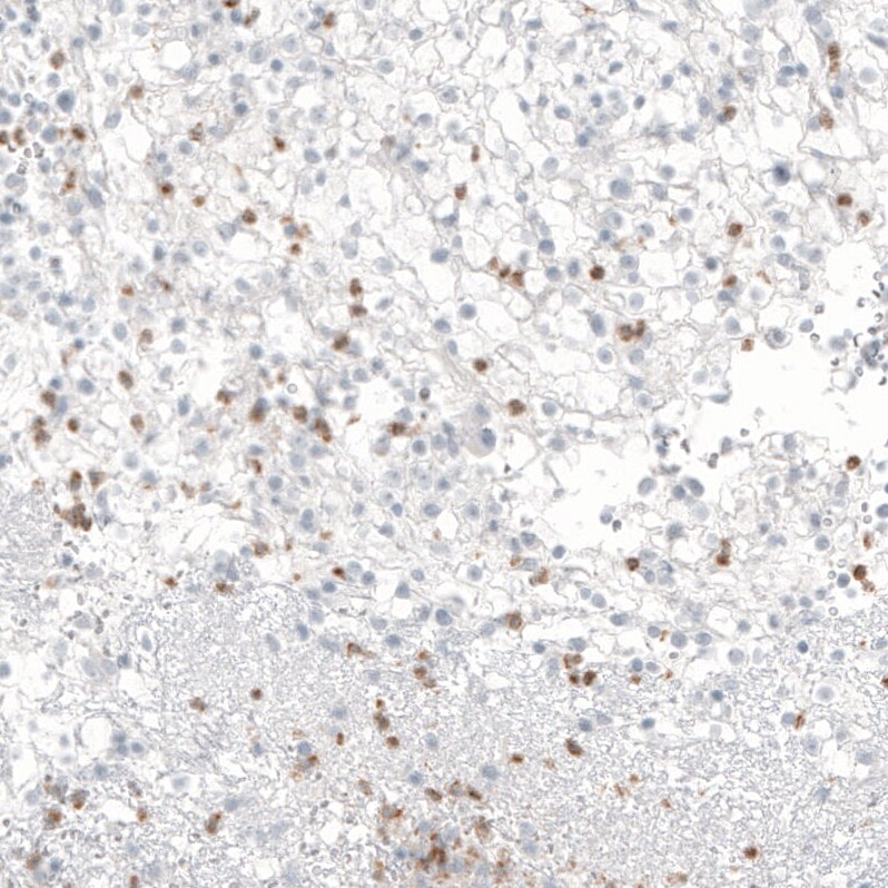 Immunohistochemistry-Paraffin: beta-1,3-Glucuronyltransferase 1/B3GAT1 Antibody [NBP3-21171] -