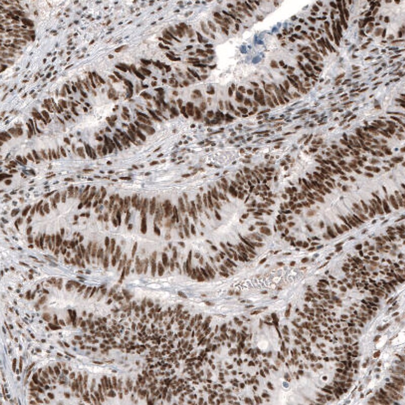 Immunohistochemistry-Paraffin: c-jun Antibody [NBP3-21172] -