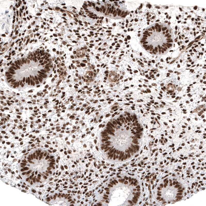 Immunohistochemistry-Paraffin: c-jun Antibody [NBP3-21172] -