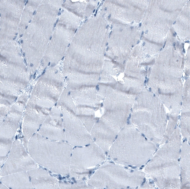 Immunohistochemistry-Paraffin: alpha-Fetoprotein/AFP Antibody [NBP3-21173] -