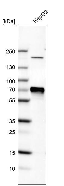 Western Blot: alpha-Fetoprotein/AFP Antibody [NBP3-21173] -