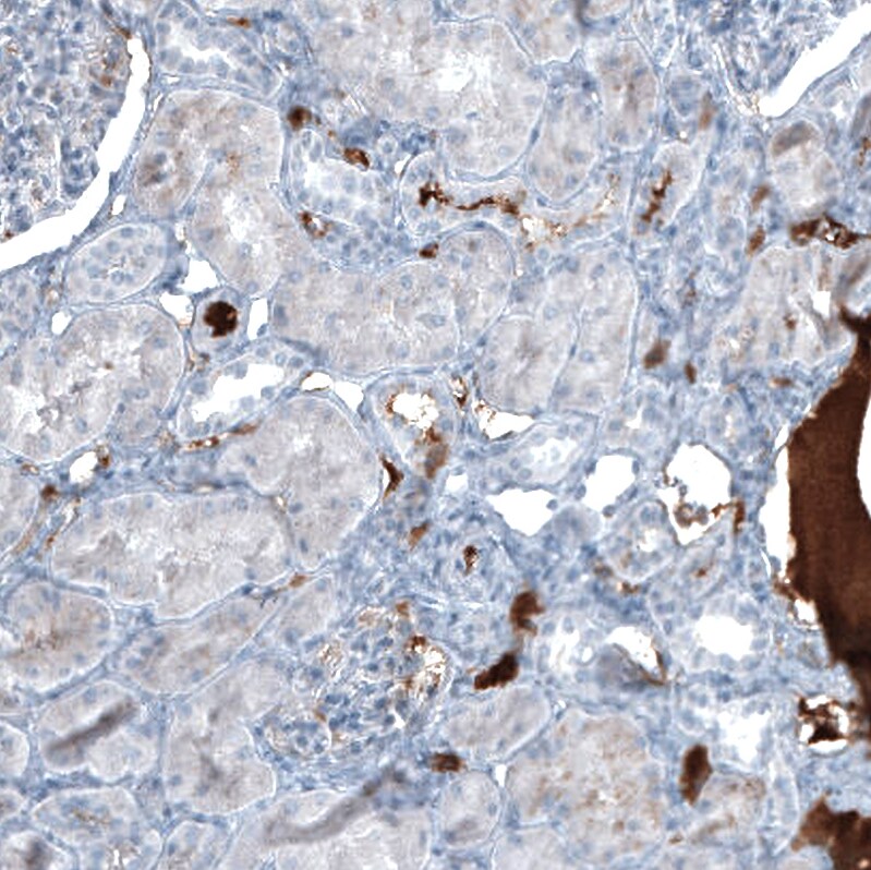 Immunohistochemistry-Paraffin: alpha-Fetoprotein/AFP Antibody [NBP3-21173] -