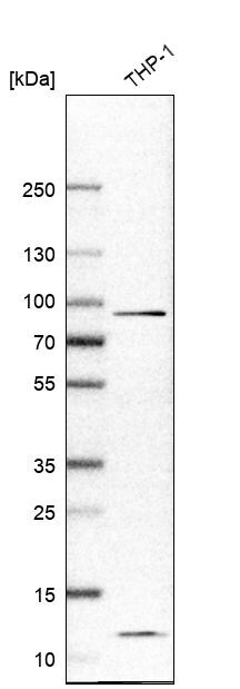 Western Blot: IL-17RA/IL-17R Antibody [NBP3-21175] -
