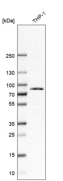 Western Blot: TLR2 Antibody [NBP3-21176] -