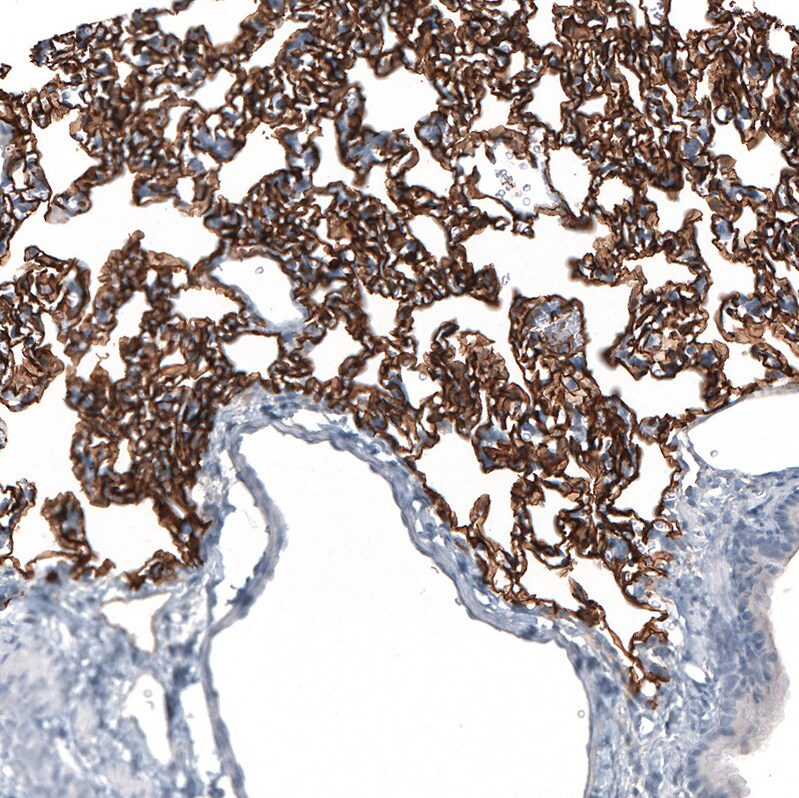 Immunohistochemistry-Paraffin: AGER Antibody [NBP3-21177] -