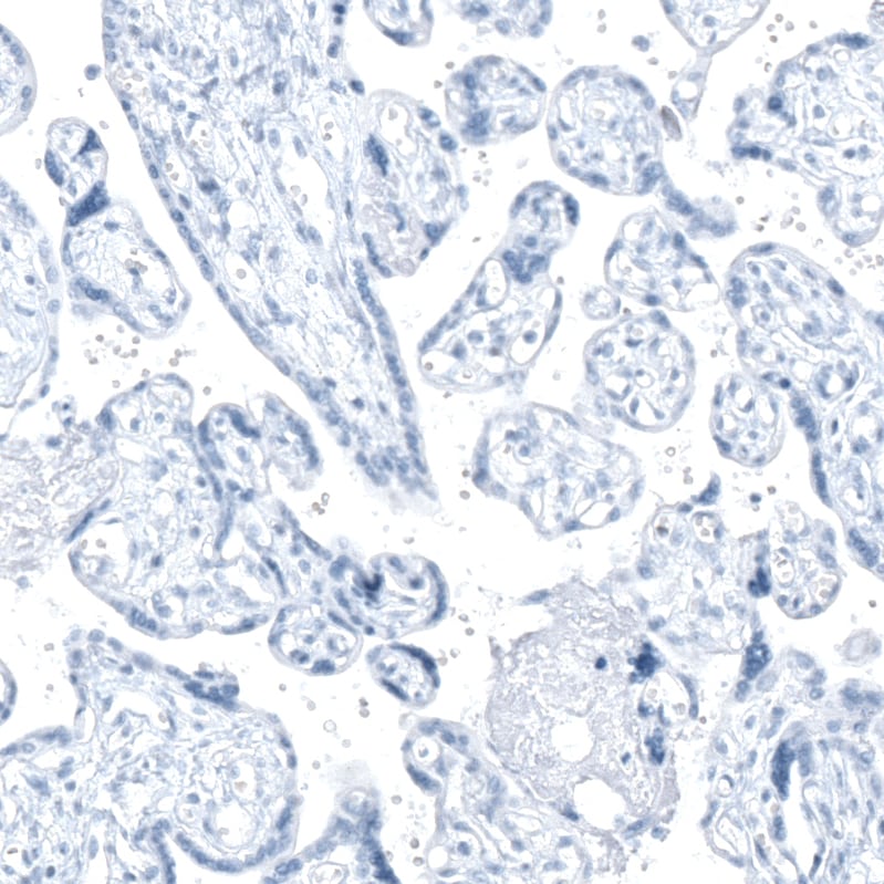 Immunohistochemistry-Paraffin: AGER Antibody [NBP3-21177] -