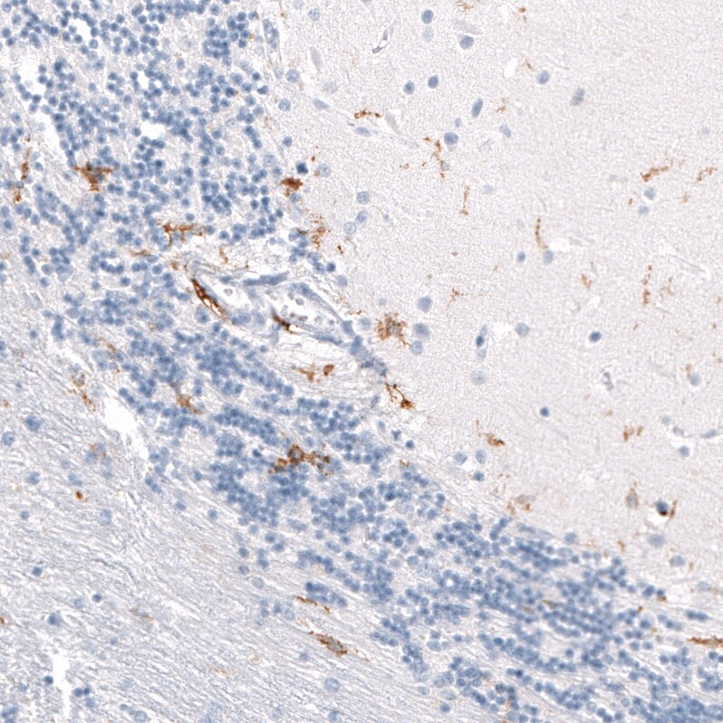 Immunohistochemistry-Paraffin: CD163 Antibody [NBP3-21179] -