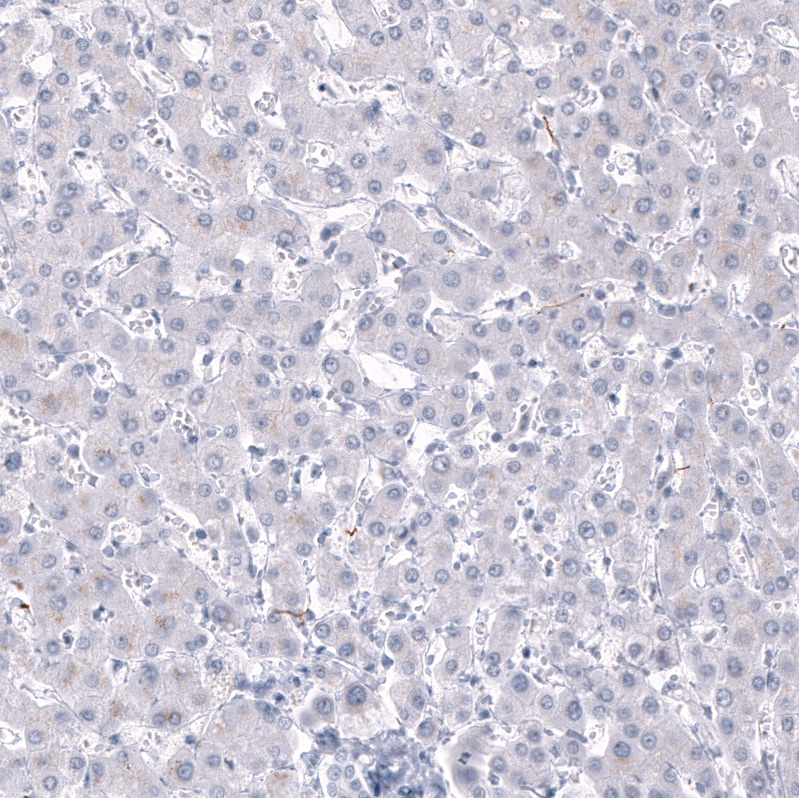 Immunohistochemistry-Paraffin: AlphaB Crystallin/CRYAB Antibody [NBP3-21180] -