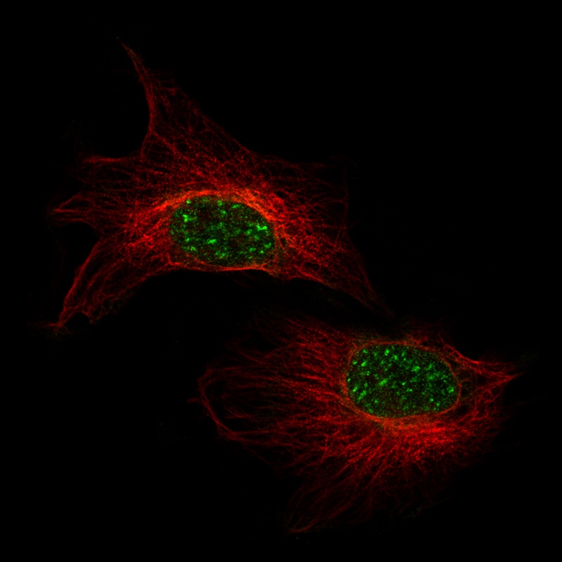 Immunocytochemistry/Immunofluorescence: AlphaB Crystallin/CRYAB Antibody [NBP3-21180] -