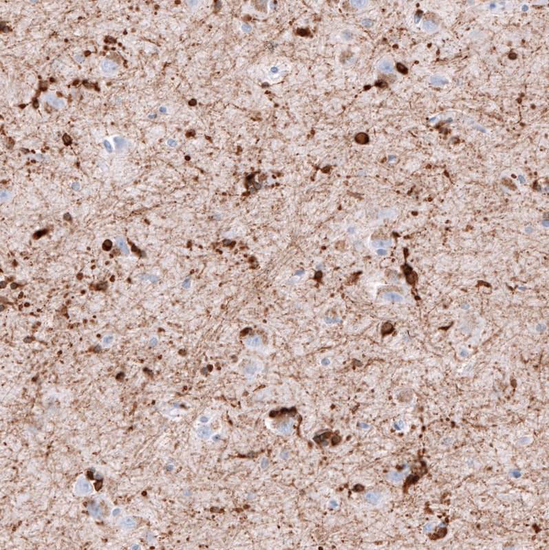 Immunohistochemistry-Paraffin: AlphaB Crystallin/CRYAB Antibody [NBP3-21180] -