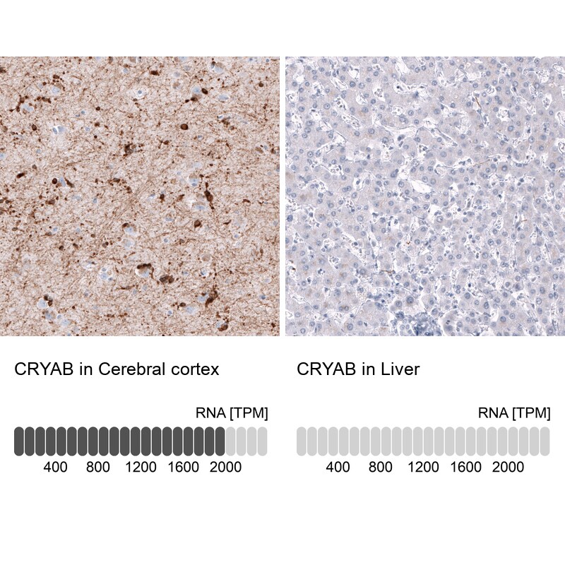 Immunohistochemistry-Paraffin: AlphaB Crystallin/CRYAB Antibody [NBP3-21180] -