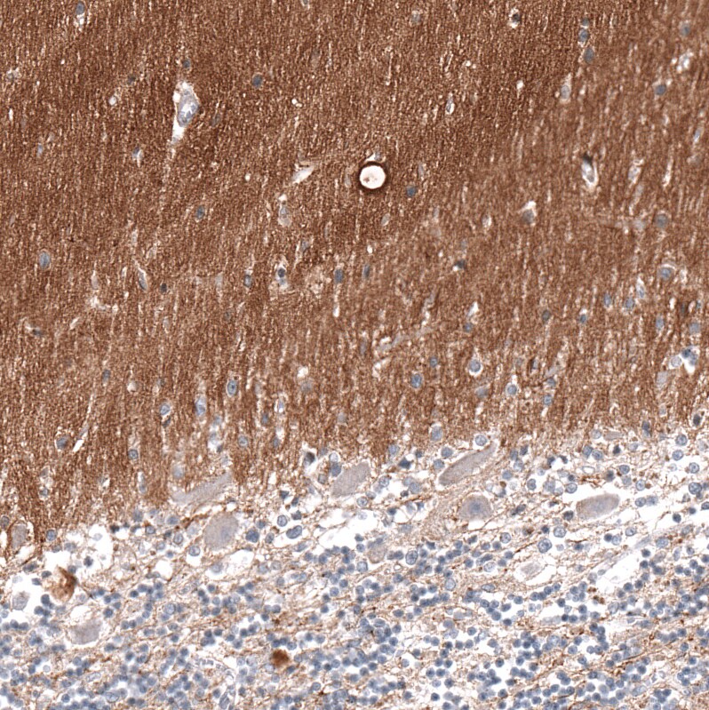 Immunohistochemistry-Paraffin: GAP-43 Antibody [NBP3-21181] -