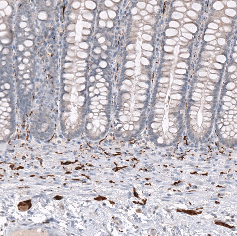 Immunohistochemistry-Paraffin: GAP-43 Antibody [NBP3-21181] -