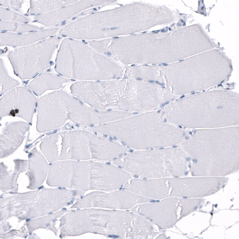 Immunohistochemistry-Paraffin: GAP-43 Antibody [NBP3-21182] -