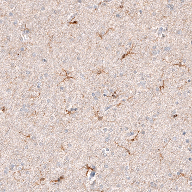 Immunohistochemistry-Paraffin: AIF-1/Iba1 Antibody [NBP3-21184] -