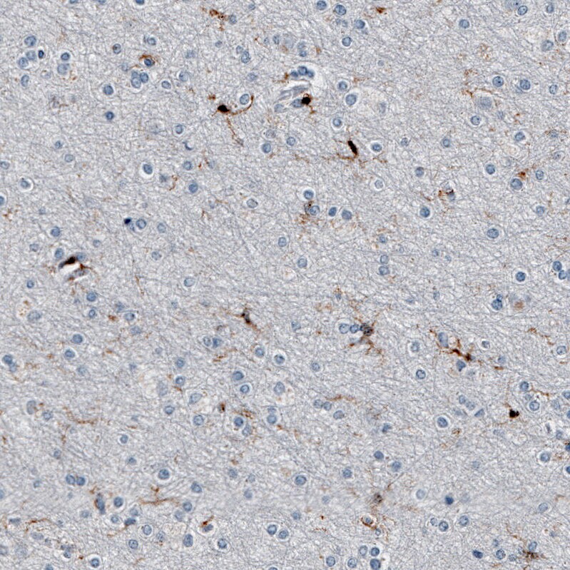 Immunohistochemistry-Paraffin: AIF-1/Iba1 Antibody [NBP3-21185] -