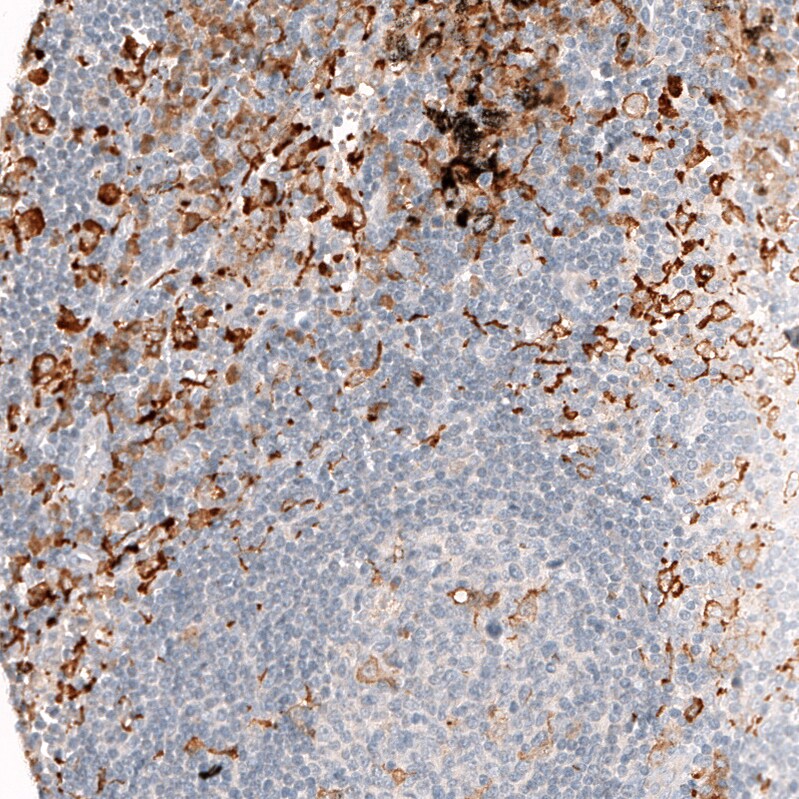 Immunohistochemistry-Paraffin: AIF-1/Iba1 Antibody [NBP3-21185] -