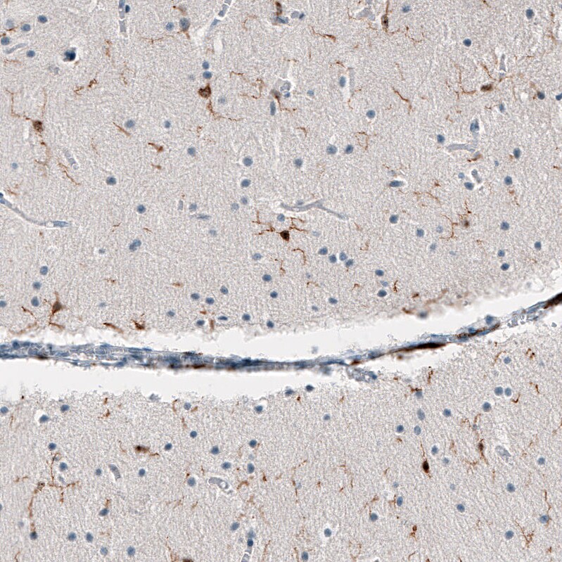 Immunohistochemistry-Paraffin: AIF-1/Iba1 Antibody [NBP3-21185] -