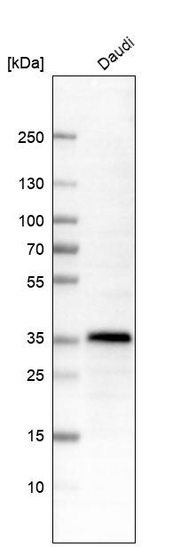 Western Blot: HLA DR/DP Antibody [NBP3-21186] -
