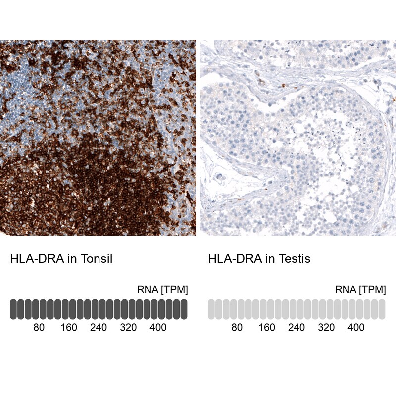 Immunohistochemistry-Paraffin: HLA DR/DP Antibody [NBP3-21186] -