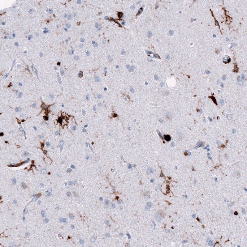 Immunohistochemistry-Paraffin: HLA DR/DP Antibody [NBP3-21186] -