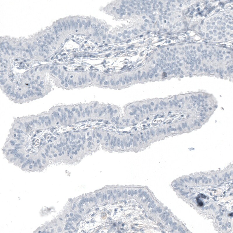 OTP Antibody (CL11222) - BSA Free Immunohistochemistry: OTP Antibody (CL11222) [NBP3-52486]