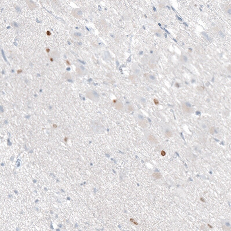 OTP Antibody (CL11222) - BSA Free Immunohistochemistry: OTP Antibody (CL11222) [NBP3-52486]