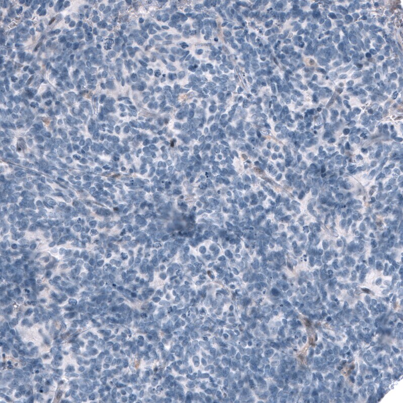 OTP Antibody (CL11222) - BSA Free Immunohistochemistry: OTP Antibody (CL11222) [NBP3-52486]