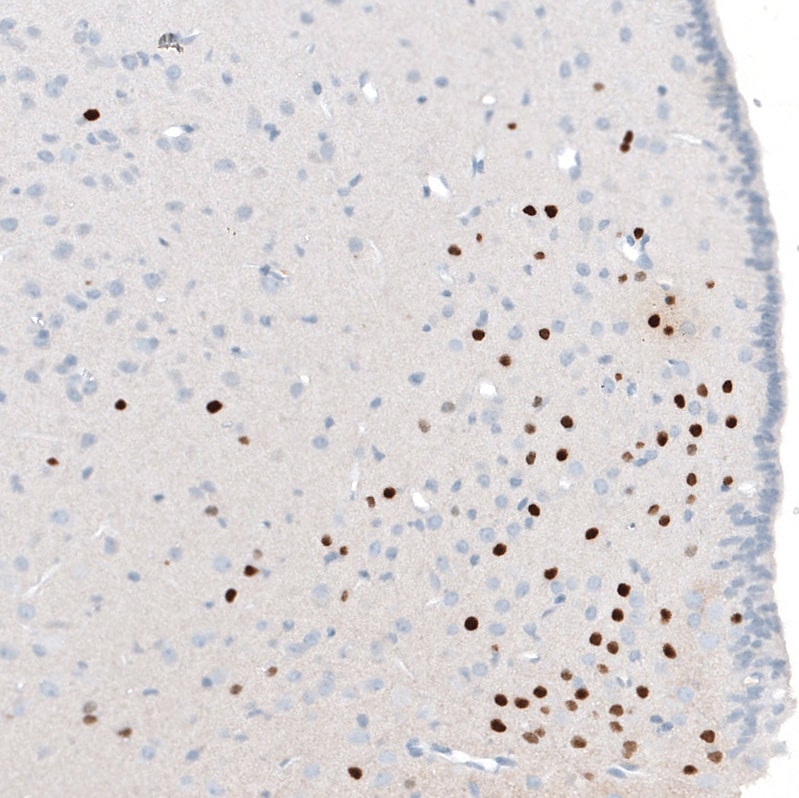 OTP Antibody (CL11222) - BSA Free Immunohistochemistry: OTP Antibody (CL11222) [NBP3-52486]