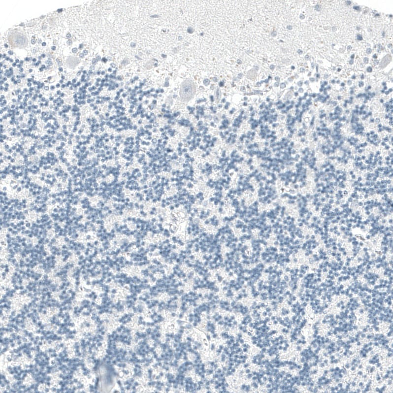 Immunohistochemistry-Paraffin: OTP Antibody [NBP3-21188] -