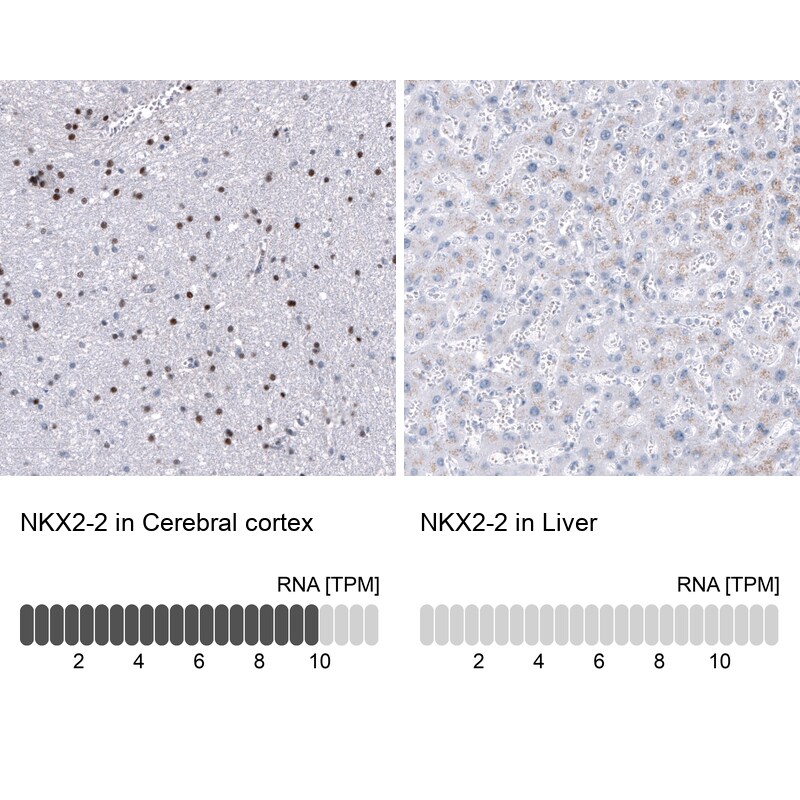 Immunohistochemistry-Paraffin: NKX2.2 Antibody [NBP3-21191] -
