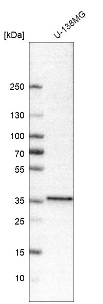 Western Blot: NKX2.2 Antibody [NBP3-21191] -