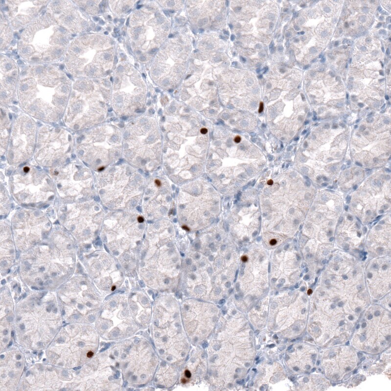 Immunohistochemistry-Paraffin: NKX2.2 Antibody [NBP3-21191] -