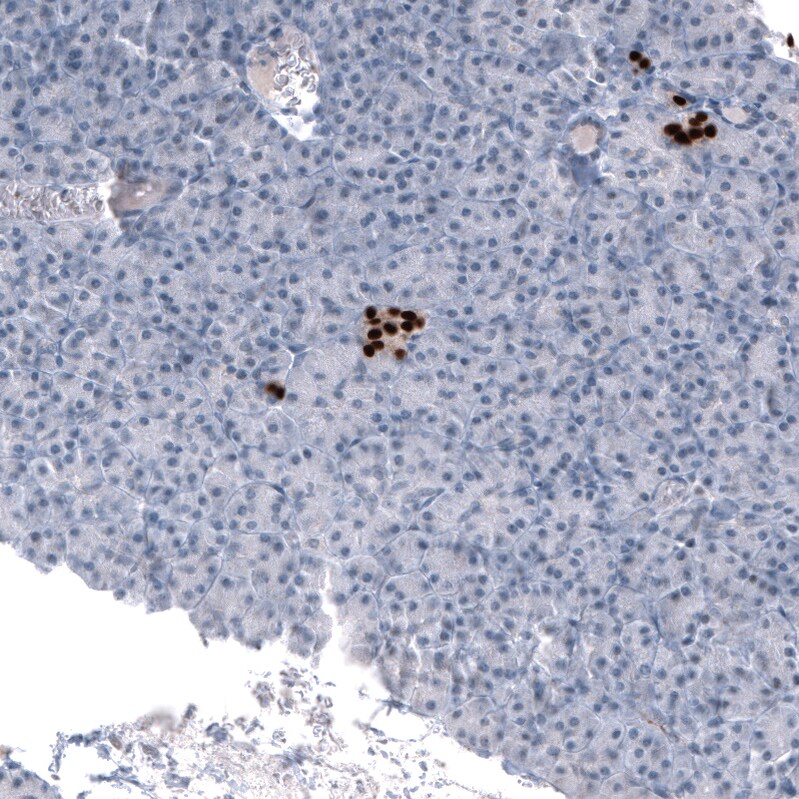Immunohistochemistry-Paraffin: NKX2.2 Antibody [NBP3-21191] -