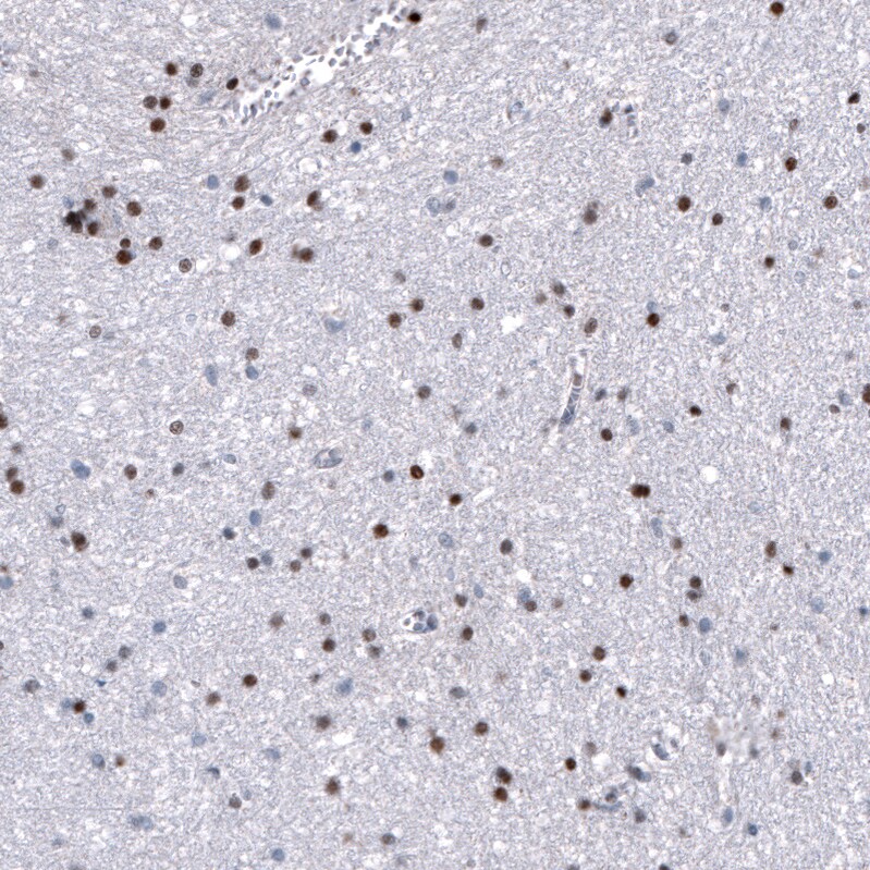 Immunohistochemistry-Paraffin: NKX2.2 Antibody [NBP3-21191] -