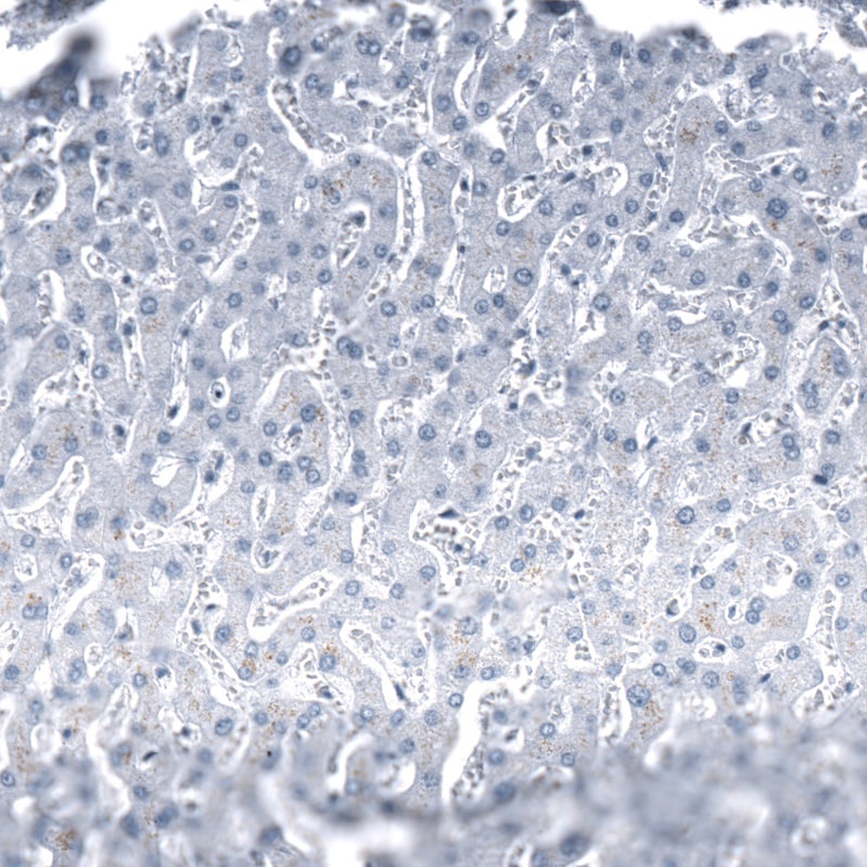 Immunohistochemistry-Paraffin: Chromogranin B Antibody [NBP3-21192] -