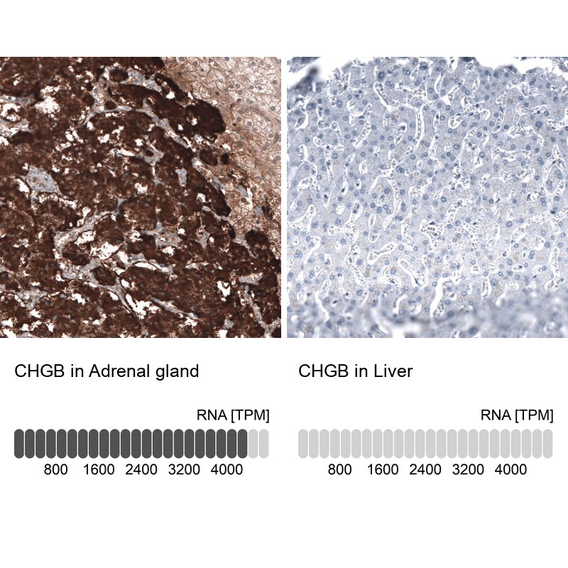 Immunohistochemistry-Paraffin: Chromogranin B Antibody [NBP3-21192] -