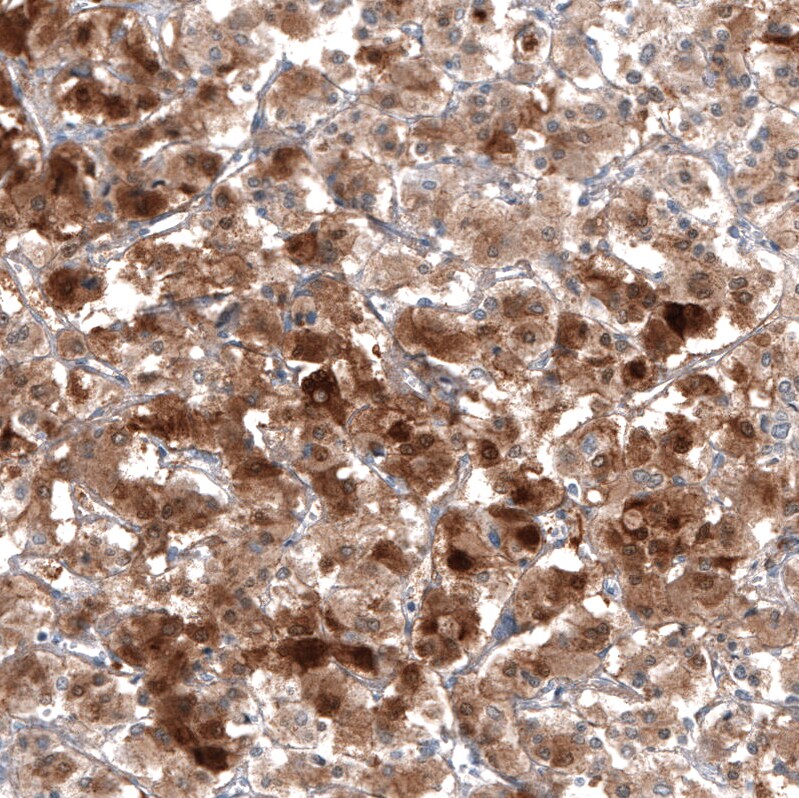 Immunohistochemistry-Paraffin: PNMT Antibody [NBP3-21193] -